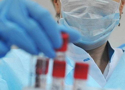 �� ������ �� ����� ������� 81 ������ ����������� �������������� ���������