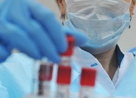 �� ������ �� ����� ������� 81 ������ ����������� �������������� ���������