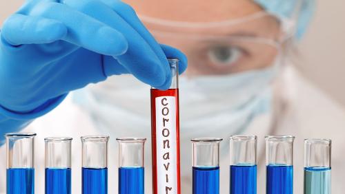 �� ����� � ������� �������� 84 ������ ����������� COVID-19